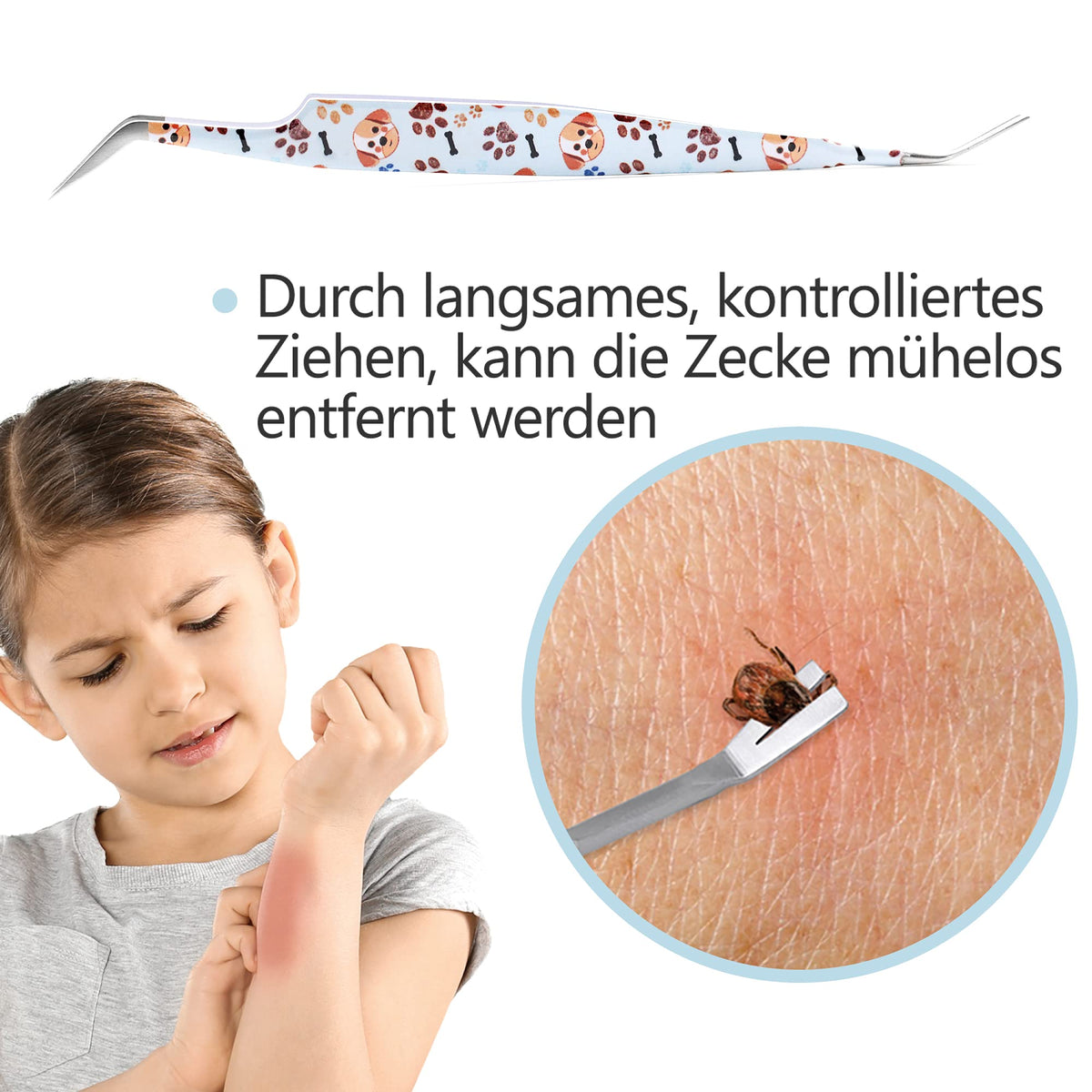 2-in-1 Profi Zeckenzange - für Hunde und Katzen - Hellblau mit spitzem Haken zum sicheren Entfernen von Zecken durch langsames Ziehen.