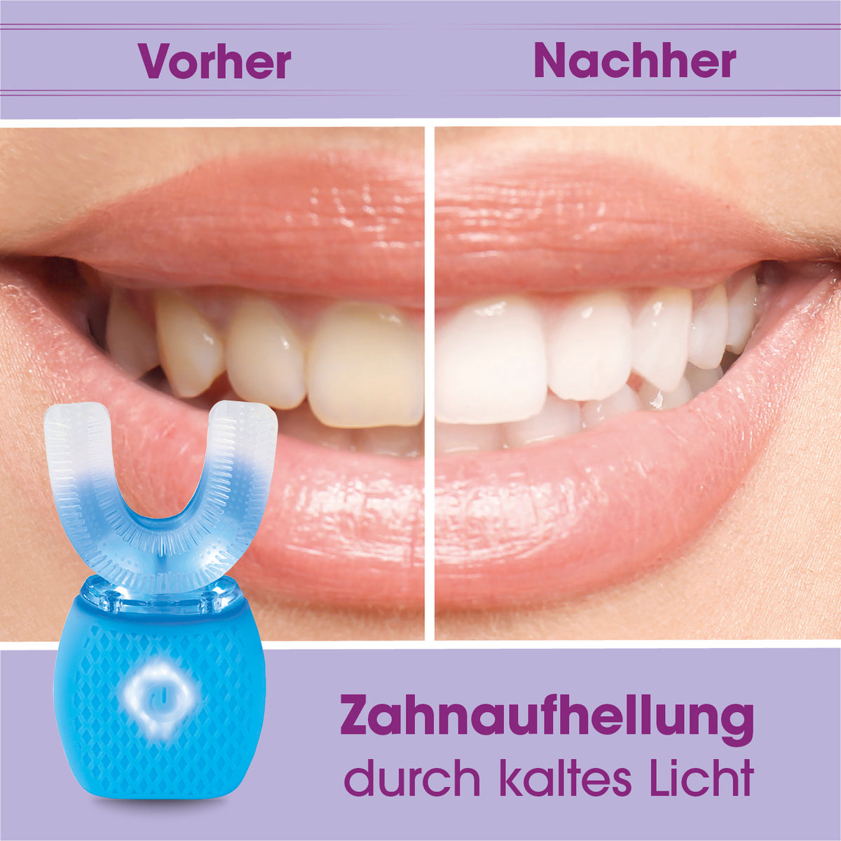 360° Schall-Zahnbürste mit LED-Blaulicht & Vibration bei Zahnaufhellung durch kaltes Licht