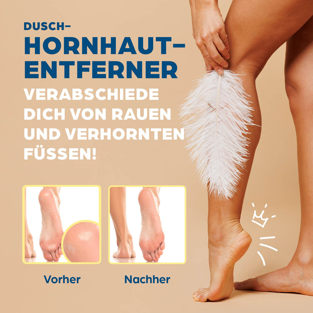 Hornhautentferner für die Dusche - Weiß zur mühelosen und hygienischen Hornhautentfernung direkt unter der Dusche von HornyFeet.