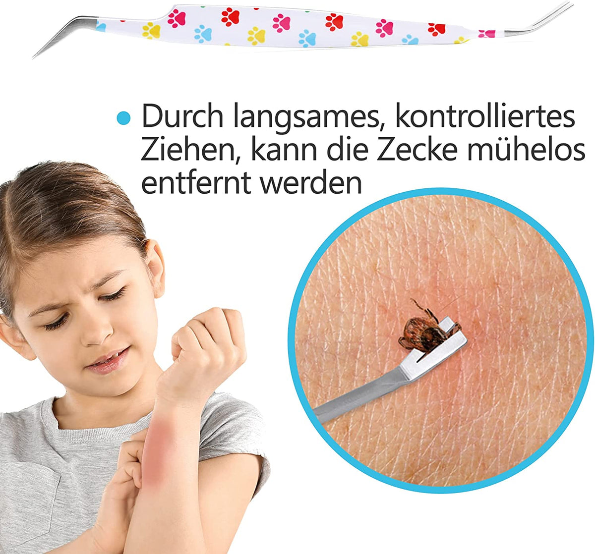2-in-1 Profi Zeckenzange - für Hunde und Katzen - Weiß zum kontrollierten Entfernen von Zecken