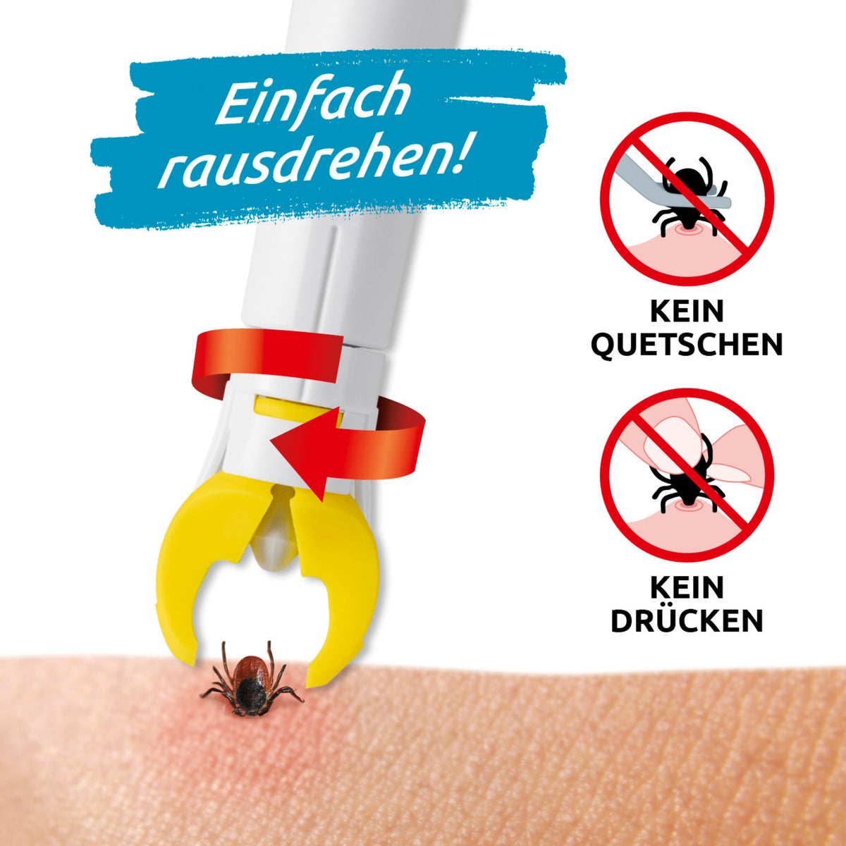 Zeckengreifer für Menschen mit rotierendem Greiferkopf - 2er-Set mit sanfter Drehung gegen Quetschen und Drücken von Zecken am Körper.